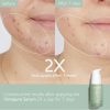 Caudalie Vinopure Blemish Control Salicylic Serum 30ml - Image 2