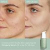 Caudalie Vinopure Blemish Control Salicylic Serum 30ml - Image 7