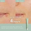 Caudalie Vinopure Salicylic Spot Solution 15ml - Image 2